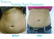 Looking for Tummy Tuck and Cosmetic surgeon in Delhi NCR, Cosmetic surgery in Delhi NCR