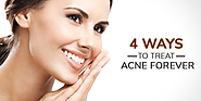 4 Ways to Treat Acne Forever