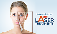 Know all about Acne Laser Treatments
