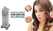 KNOW ALL ABOUT ACNE SCARS AND ACUPULSE