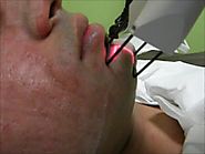 Laser Treatment for Acne Scars in Mumbai - Dermatologistmumbai.com