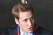 Why Is Prince William Going Bald?