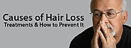 Causes of Male pattern Hair Loss