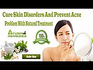 Cure Skin Disorders And Prevent Acne Problem With Natural Treatment