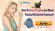 How To Cure Pimples And Black Patches With Herbal Treatment?