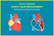 Trans Catheter Aortic Valve Replacement: What All You Need To Know