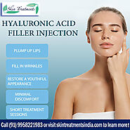 Hyaluronic Acid Filler Treatment in Delhi
