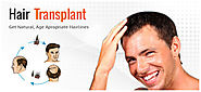Get Natural Hair Go Hair Transplant Clinic