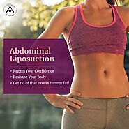 Abdominoplasty in Delhi