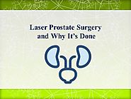 Laser Prostate Surgery And Why It’S Done