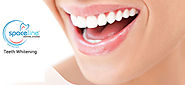 Excellent Teeth Whitening Solution at The Affordable Price
