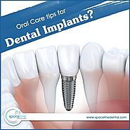 Oral Care Tips for Dental Implants