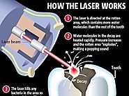 Painless Dental Treatment With Advanced Laser Technology