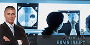 How to Make a claim for brain injuries In UK
