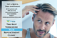 The Best Yorkshire Hair Replacement Clinic - Rejuvenate