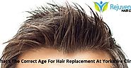 What's The Correct Age For Hair Replacement At Yorkshire Clinic?