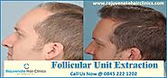 Follicular Hair Transplant In UK - Rejuvenate Hair Clinics
