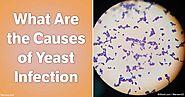 What Are the Causes of Yeast Infection?
