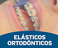 →Elásticos Em Ortodontia | Curso On-line Elásticos Ortodônticos