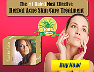 Natural Acne Supplements to Get Rid of Pimples, Dark Sports and Scars
