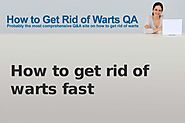 How to get rid of warts fast