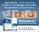 Best 10 Skin Lightening Cream Without Hydroquinone
