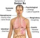 H1N1 (Swine Flu)
