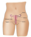 Cyst Ovary During Pregnancy (with image) · jimmy966