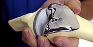 What Conditions Lead To A Knee Replacement Surgery?