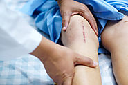 Common Complications That Occur After Surgery