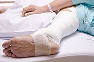 Wound Care Tips After a Stitch Removal