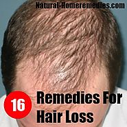 NATURAL HOME REMEDIES FOR BALDNESS / HAIR LOSS