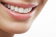 Dental Implants: What makes it a Good Choice?