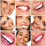 What You Need To Know About Veneers?