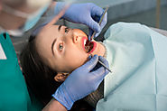 The Benefits of Having Dental Implants