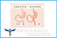 Gastric Bypass Surgery Clinic for Weight Loss in Perth