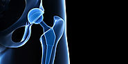 How Can You Recover After A Total Hip Replacement Surgery?
