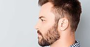 Get Painless Beard Hair Transplant From One Of The Top-Notch Clinics In London