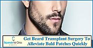 Get best Beard Transplant Surgery in uk – Rejuvenate Hair Clinics