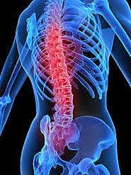 Network Spinal Analysis On Gold Coast
