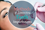 Methods In Correcting Teeth Imperfections