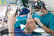 How Much Does FUE Hair Transplant Cost?