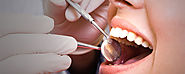 Wisdom Tooth Removal cost and procedure