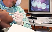 Everything You Need to Know about Intraoral Dental Cameras - Ajax Dental Supplies Pty Ltd