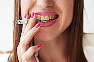 Why Patients Should Quit Smoking If They Want to Get Dental Implants