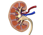 How Do You Get Rid of Kidney Stones