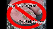 4 Natural Home Remedies to Cure Nail Fungus!