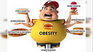 How do you control obesity?