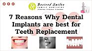 7 Reasons Why Dental Implants are Best for Teeth Replacement
