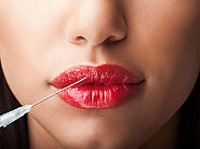 Get More Beautiful Lips With Filler Treatments